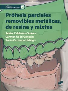 Prótesis parciales removibles metálicas, de resina y mixtas·Prótesis dentales